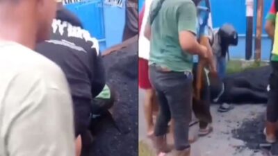 Begini Kondisi Ojol yang Terluka Parah Akibat Tertimpa Aspal Panas dan Viral