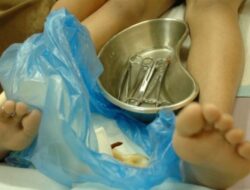 Mengapa Sunat Wanita Berbahaya? Risiko Kesehatan Tersembunyi