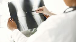 5 Tips Mencegah Osteoporosis Agar Tulang Tetap Kuat
