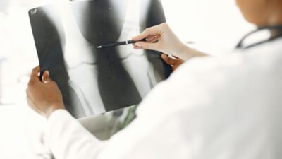 5 Tips Mencegah Osteoporosis Agar Tulang Tetap Kuat