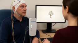 Alzheimer: Penyakit Otak yang Mengancam Lansia